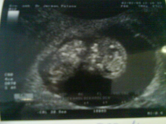 Naša prva sreča - foto povečava