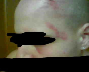 Glava - foto povečava